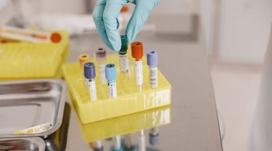 Terjed az új himlőmutáns: járványhullám söpörhet végig Európán Terjed az új himlőmutáns: járványhullám söpörhet végig Európán