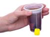Vigyázz, egészségtelenné válik a tea és a kávé, ha így iszod