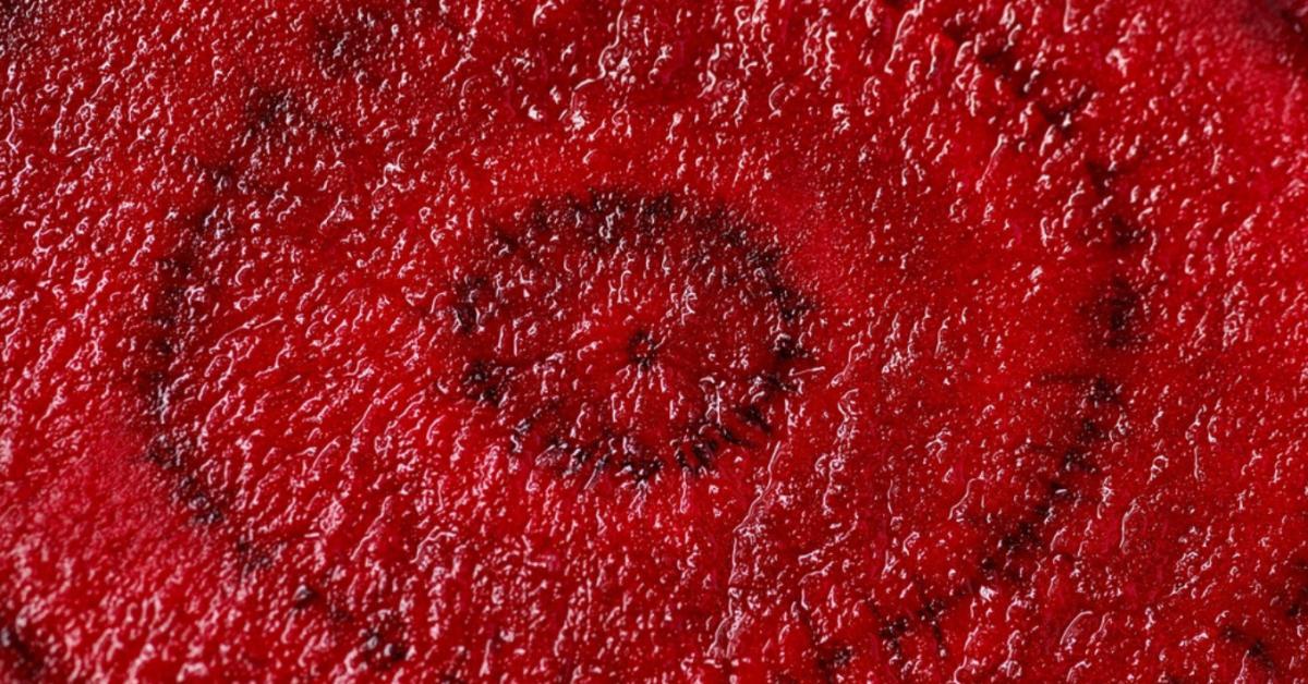 Vigyázz! A cékla komolyan megbetegíthet! Vigyázz! A cékla komolyan megbetegíthet!
