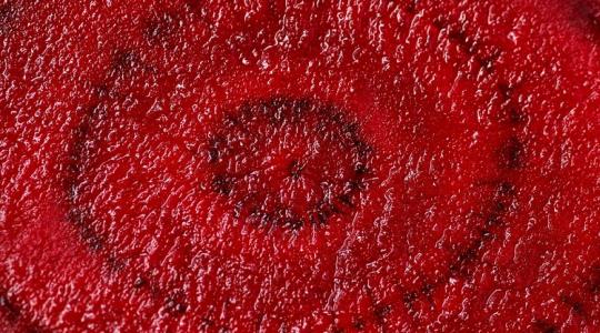 Vigyázz! A cékla komolyan megbetegíthet!