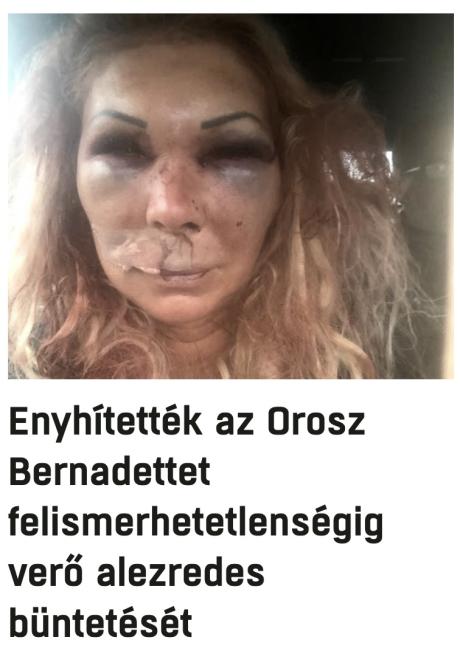 nemvicc
